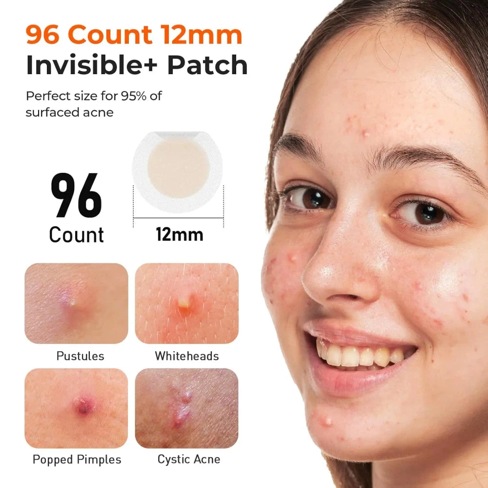 Salicylic Acid Acne Patches